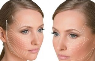 Попали в сети