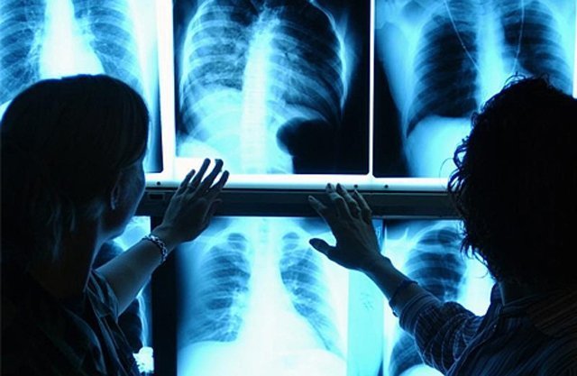 Всемирный день борьбы с туберкулезом: всю неделю можно пройти флюорографическое обследование бесплатно