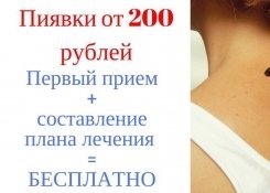 Лечение пиявками в «Лотос» в Ижевске