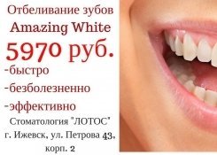 Отбеливание зубов "Amazing White" от Стоматологии Лотос. Ижевск
