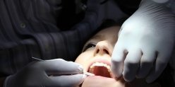 Как сохранить белизну зубов: лайфхак от стоматолога