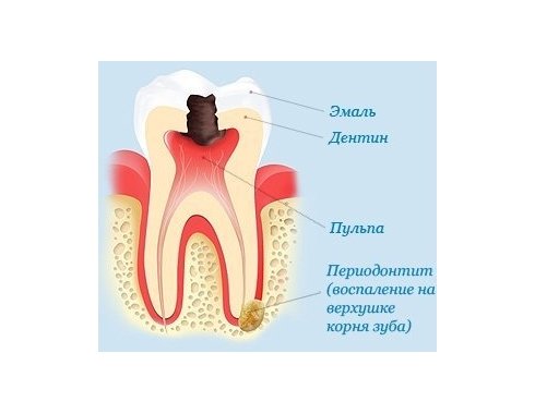 Лечение периодонтита Томск Казанский 2-й огауз томск стоматология